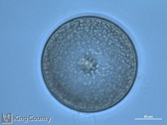 Photo of Coscinodiscus spp.